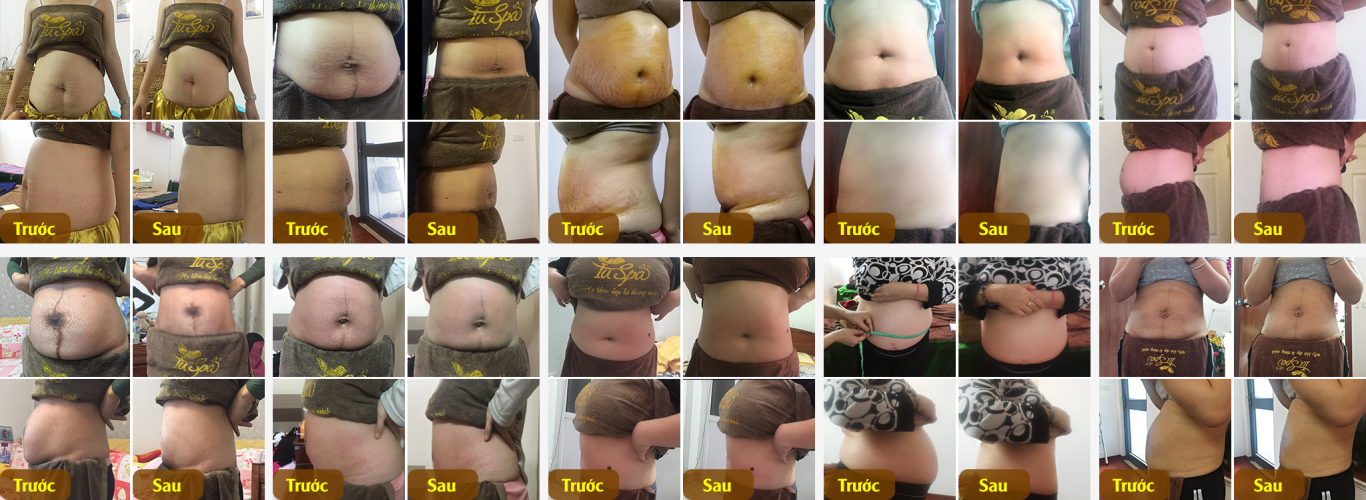 Ảnh trước và sau khi chăm sóc của các mẹ sau sinh